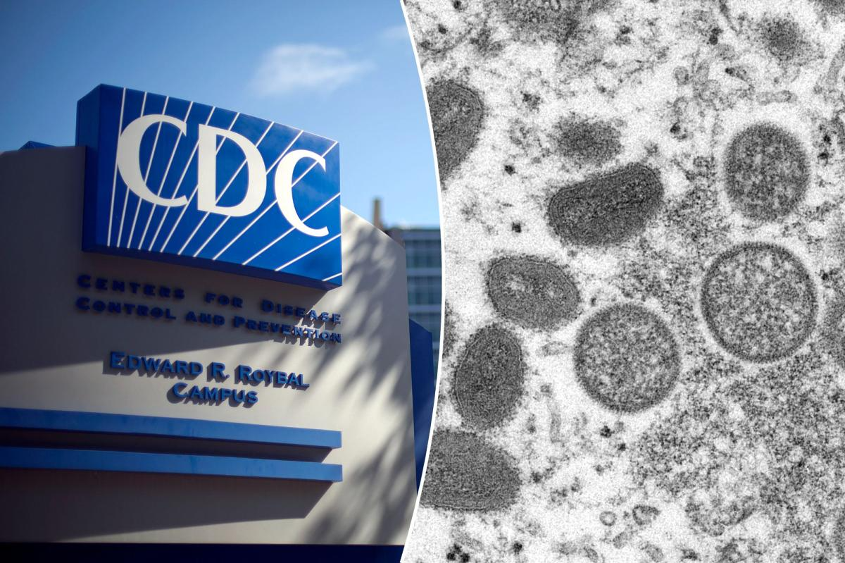 CDC Issues Warning Over New, More Deadly Strain Of Mpox